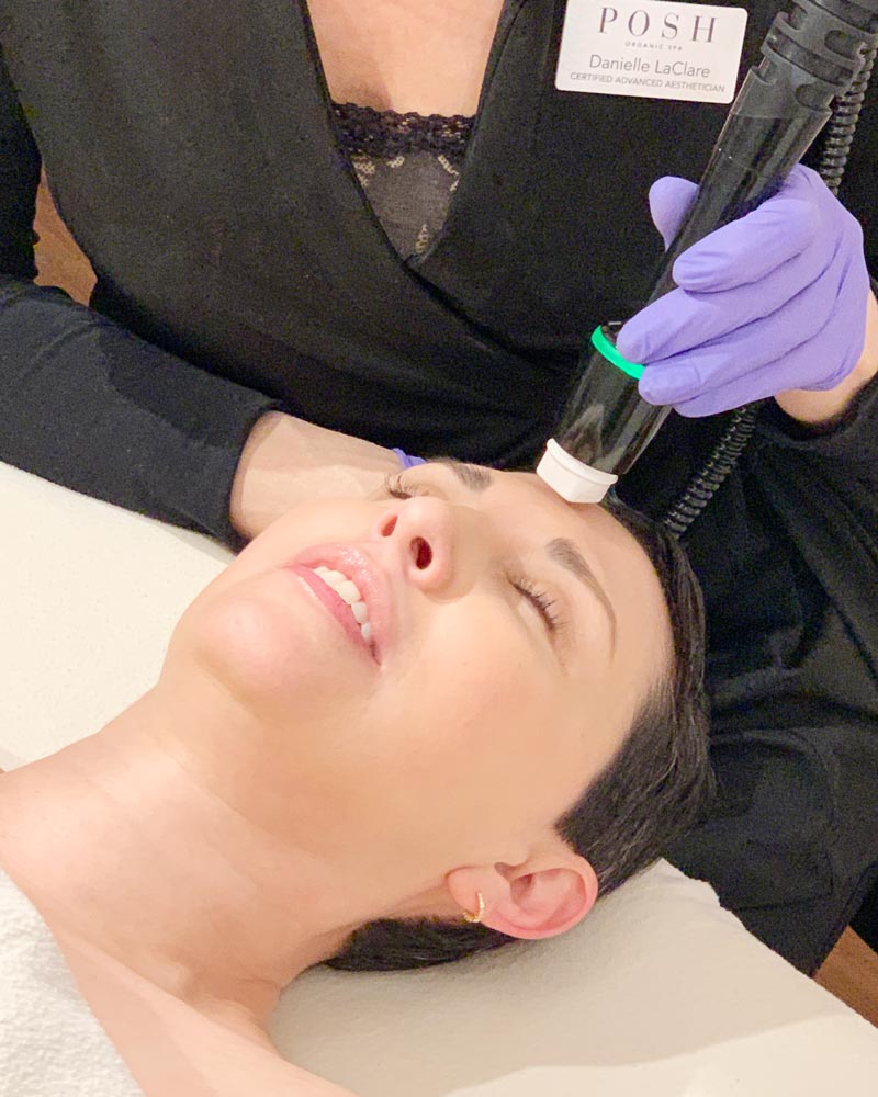 RF microneedling treatment also known as microneedling with radio frequency